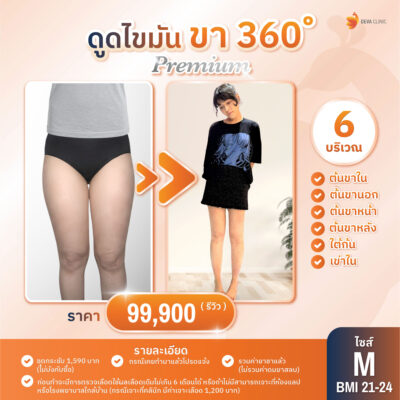 ดีว่าคลินิก ดูดไขมัน ราคา - ดูดต้นขา 02