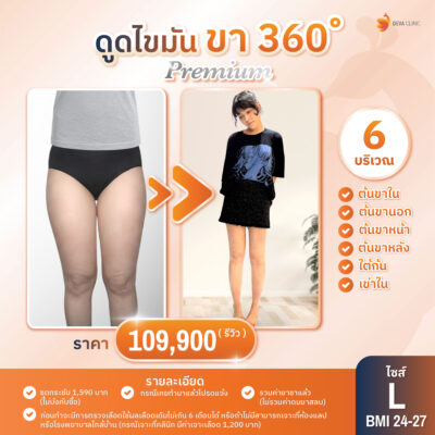 ดีว่าคลินิก ดูดไขมัน ราคา - ดูดต้นขา 03