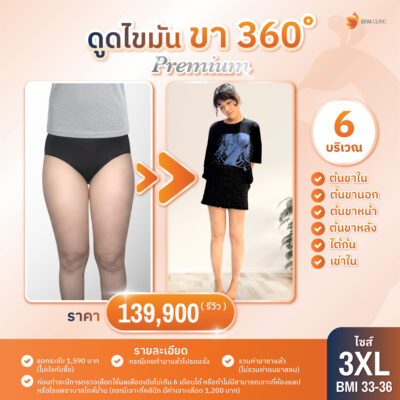 ดีว่าคลินิก ดูดไขมัน ราคา - ดูดต้นขา 06