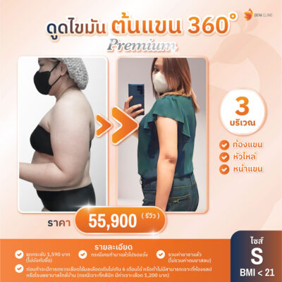 ดีว่าคลินิก ดูดไขมัน ราคา - ดูดต้นแขน 01