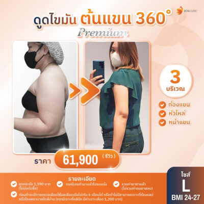 ดีว่าคลินิก ดูดไขมัน ราคา - ดูดต้นแขน 03