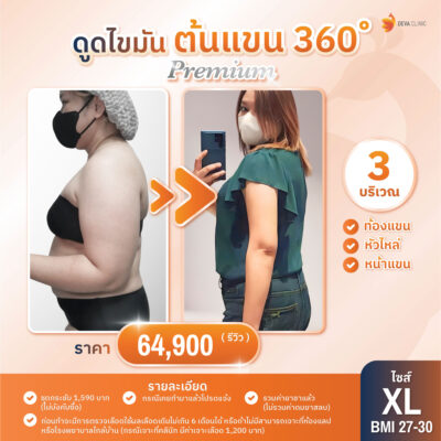 ดีว่าคลินิก ดูดไขมัน ราคา - ดูดต้นแขน 04