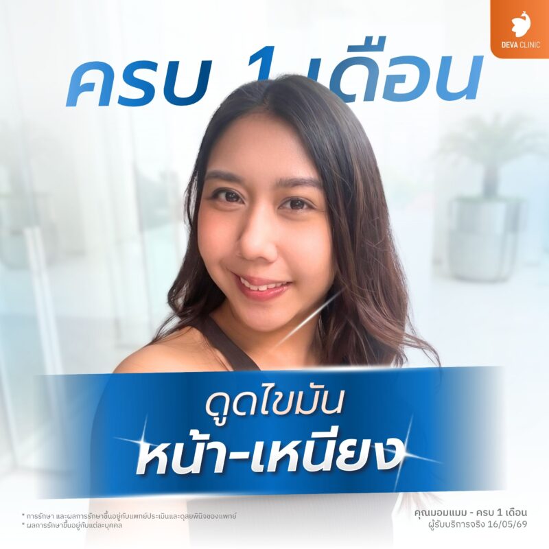 ดูดไขมันหน้าเหนียง - Deva Clinic pantip 01