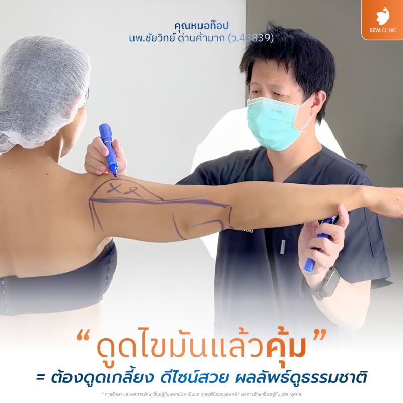 คุ้มกว่าไหม? ดูดไขมันรักแร้ร่วมกับการดูดไขมันต้นแขน เพื่อแขนเรียวเป๊ะ