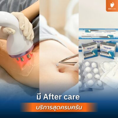 ขั้นตอนการพักฟื้นและดูแลหลังผ่าตัด (Post-op Care) เพื่อความปลอดภัยสูงสุดของคนไข้ 04