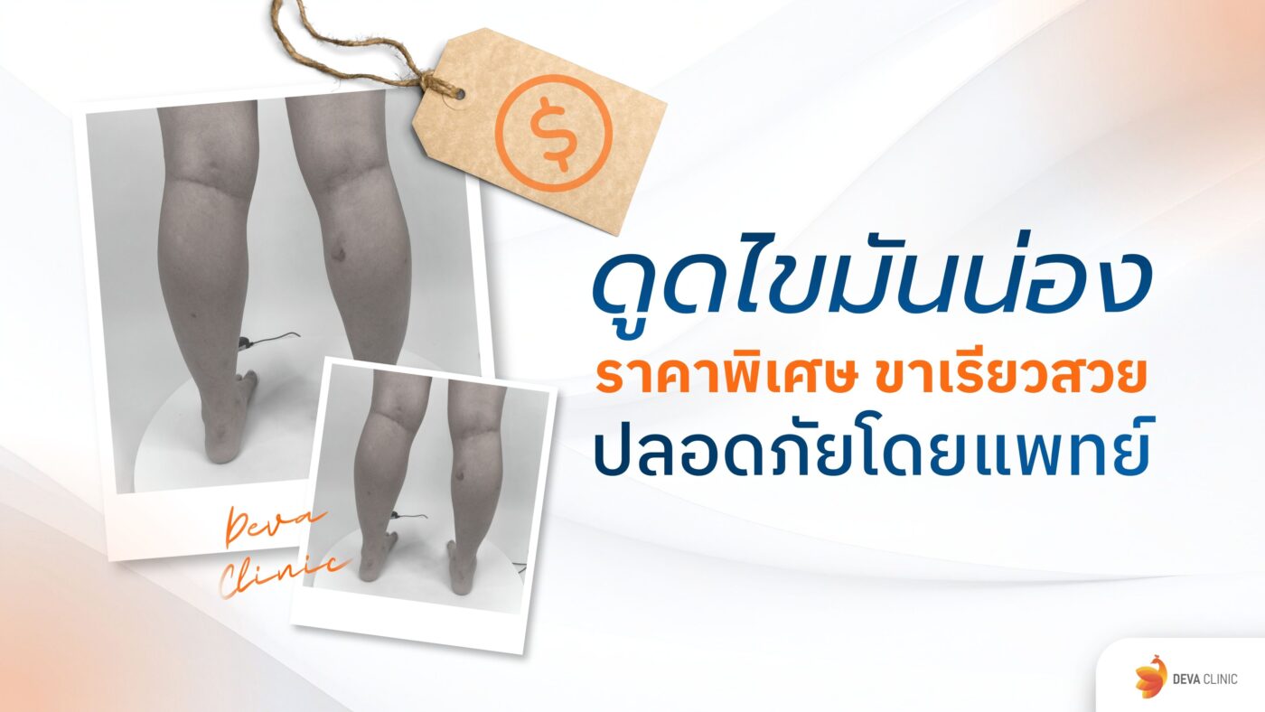 ดูดไขมันน่อง ราคา
