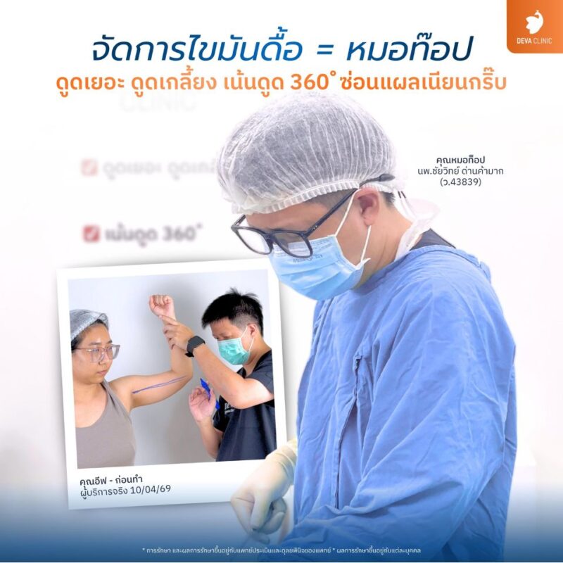 การดูแลโดยทีมแพทย์ประสบการณ์ - ดูดไขมันราคาเหมา ทั้งตัว