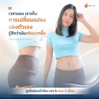 ภาพรีวิว Before & After เคสดูดไขมันเอว 4