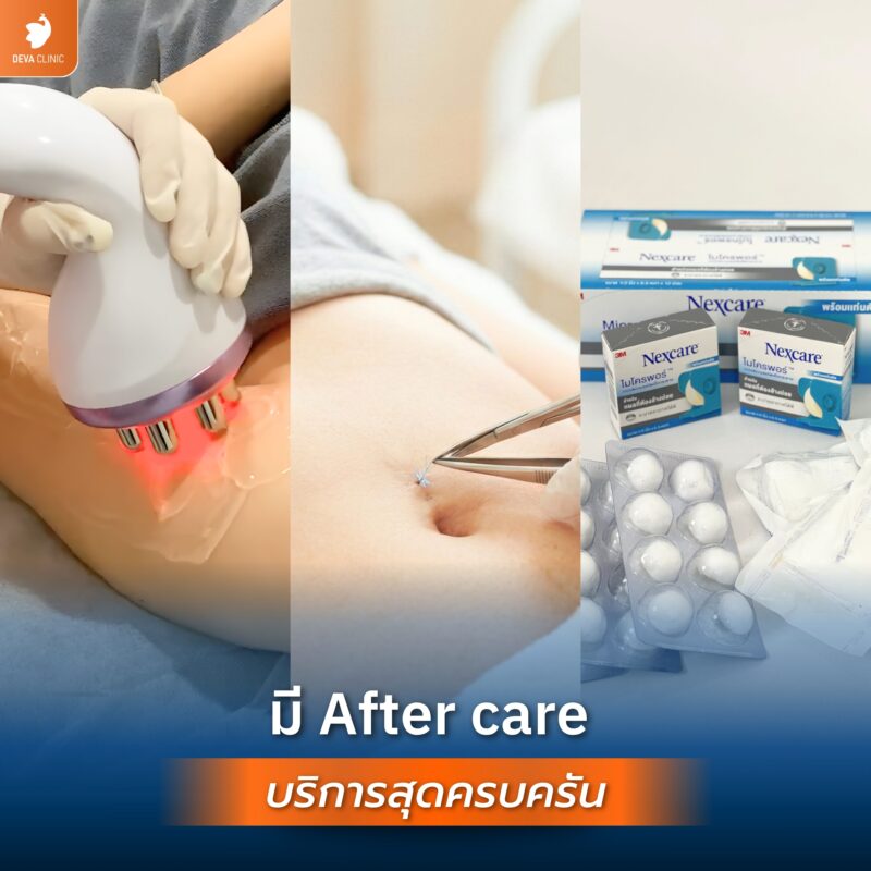After care Deva Clinic