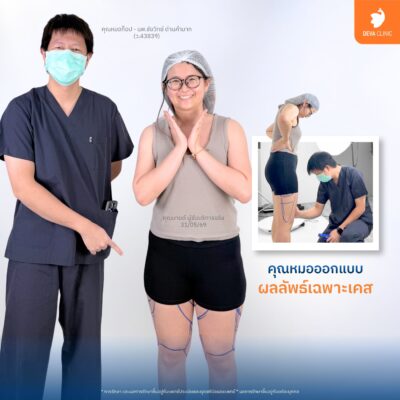 ทีมแพทย์ประสบการณ์การแพทย์สูง: ดีไซน์ส่วนเว้าโค้งเฉพาะบุคคล 1