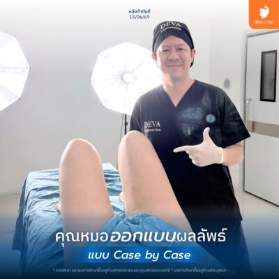 ทีมแพทย์ประสบการณ์การแพทย์สูง: ดีไซน์ส่วนเว้าโค้งเฉพาะบุคคล 2