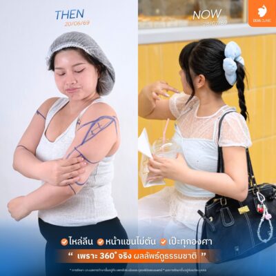 ดูดแขน 360 องศา จริงหรือเก็จ? เช็กลิสต์ 4 ข้อ ป้องกันการโดนหลอก 1