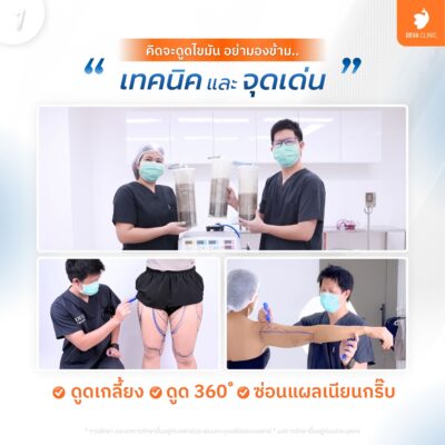เทคนิคเฉพาะ ดูดเกลี้ยง 360 องศา ซ่อนแผลเนียนกริ๊บ