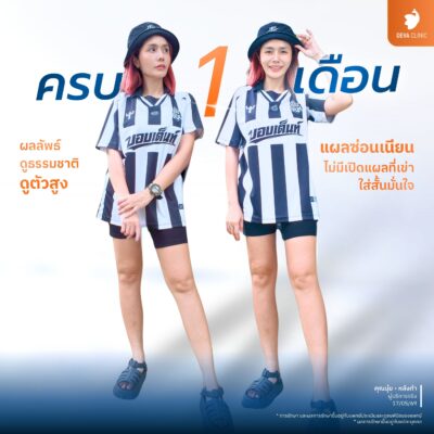 รีวิว เทคนิคซ่อนรอยแผลบริเวณรอยพับใต้ก้น 2