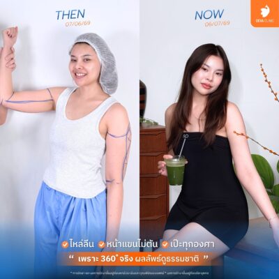 ดูดแขน 360 องศา จริงหรือเก็จ? เช็กลิสต์ 4 ข้อ ป้องกันการโดนหลอก 2