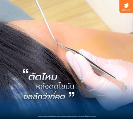 การติดตามผล (Follow-up) อย่างใกล้ชิดหลังผ่าตัด 02