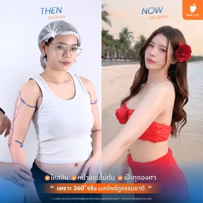 ดูดแขน 360 องศา จริงหรือเก็จ? เช็กลิสต์ 4 ข้อ ป้องกันการโดนหลอก 3