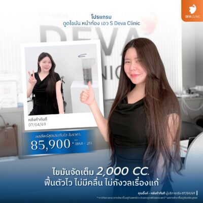 รีวิว Before & After เคสดูดไขมันรอบเอว ปีกข้าง 2