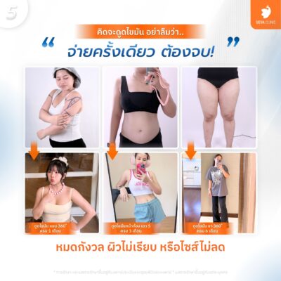 จบในครั้งเดียว หมดกังวลเรื่องผิวไม่เรียบ