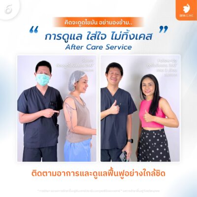 ดูแลใส่ใจ ไม่ทิ้งเคส (After Care Service)