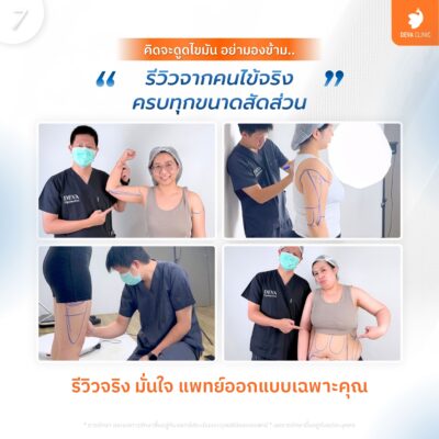 รีวิวจากคนไข้จริง ออกแบบเฉพาะบุคคล