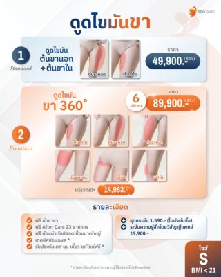 ราคาดูดไขมันต้นขา S