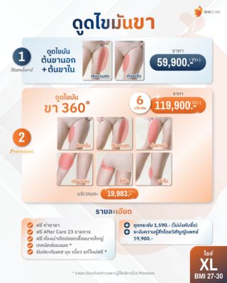 ราคาดูดไขมันต้นขา XL