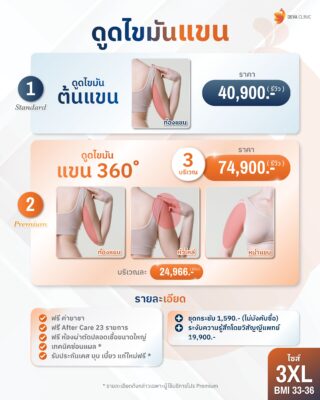 ราคาโปรโมชั่น *โปรรีวิว ดูดไขมันแขน 3xl