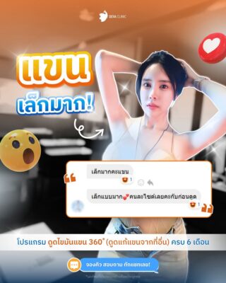 รีวิวความประทับใจ ดูดไขมันกระชับผิว ราคา 4