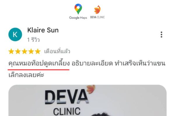 รีวิว GG ดูดไขมันเกลี้ยง 5