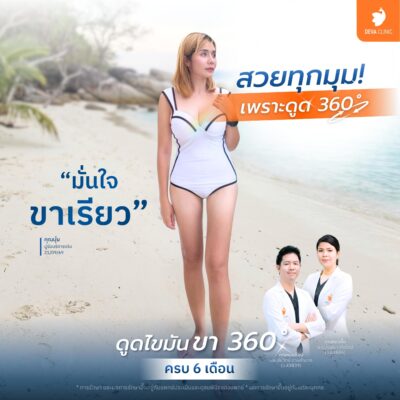 ตำแหน่งยอดฮิตที่นิยมดูดไขมันแบบซ่อนแผล - ต้นขา 5