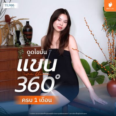 ดูดไขมันเทคนิคใหม่ ต้นแขน 360 องศา 4