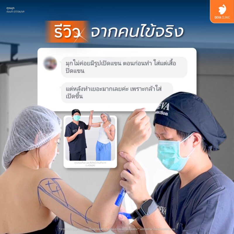 ดูดไขมันต้นแขน 360 องศา ปรับแขนเล็กเรียว ลดไซส์ชัดเจนในทุกมิติ