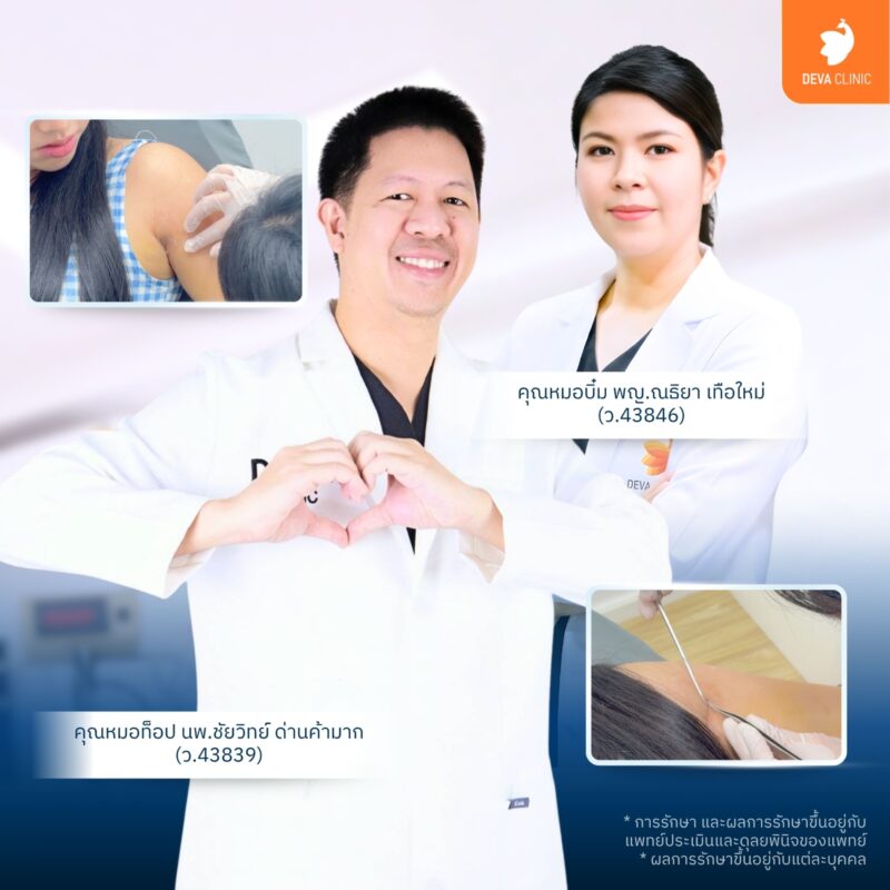 ทำไมเทคนิคซ่อนแผลถึงดีกว่าการดูดไขมันแบบปกติ