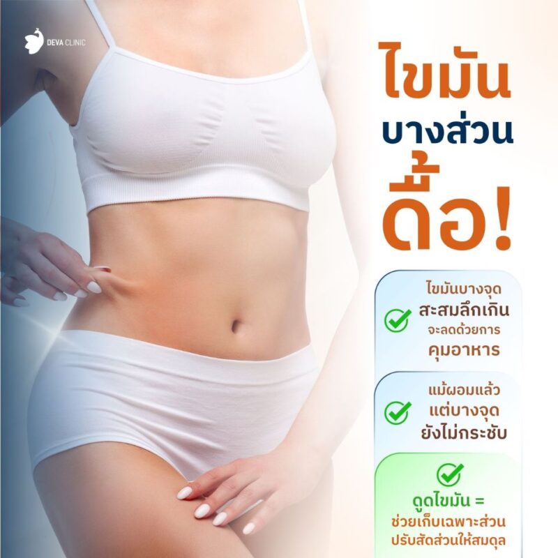 การสลายไขมันเฉพาะจุด - ดูดไขมัน ปรึกษาแพทย์ฟรี