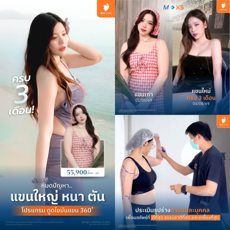 เจาะลึกการประเมินต้นแขน 360 องศา: เก็บรายละเอียด ท้องแขน, หน้าแขน และหัวไหล่