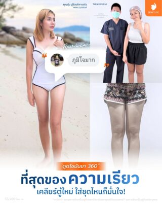 Before & After ต้นขา 360 องศา 2