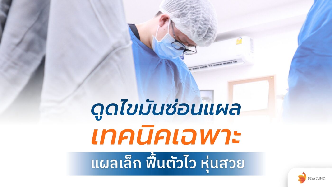 ดูดไขมันซ่อนแผล