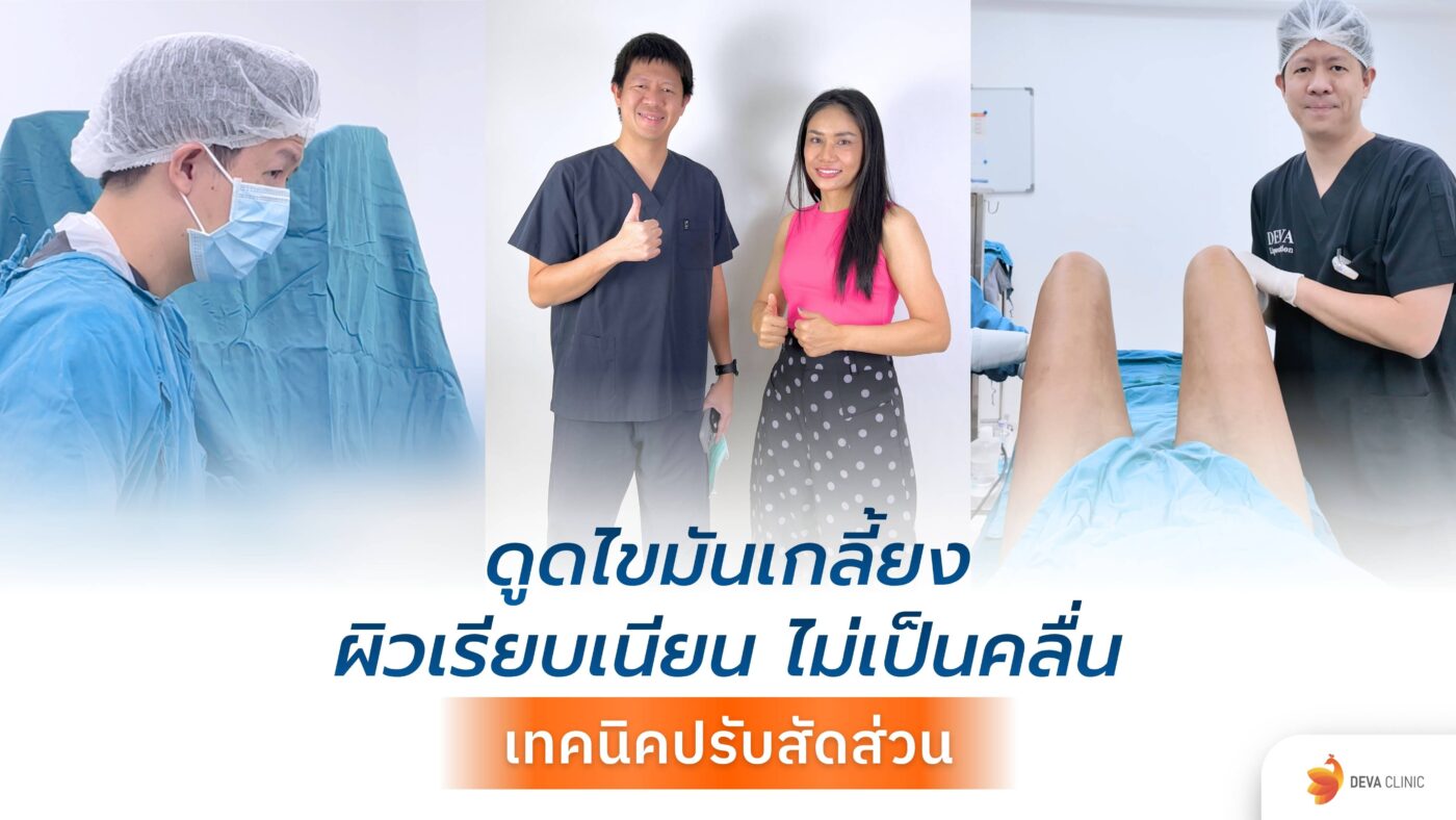 ดูดไขมันเกลี้ยง